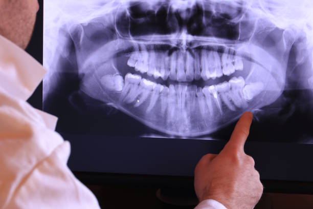 Best Urgent Care for Lost Fillings or Crowns in Norris City, IL